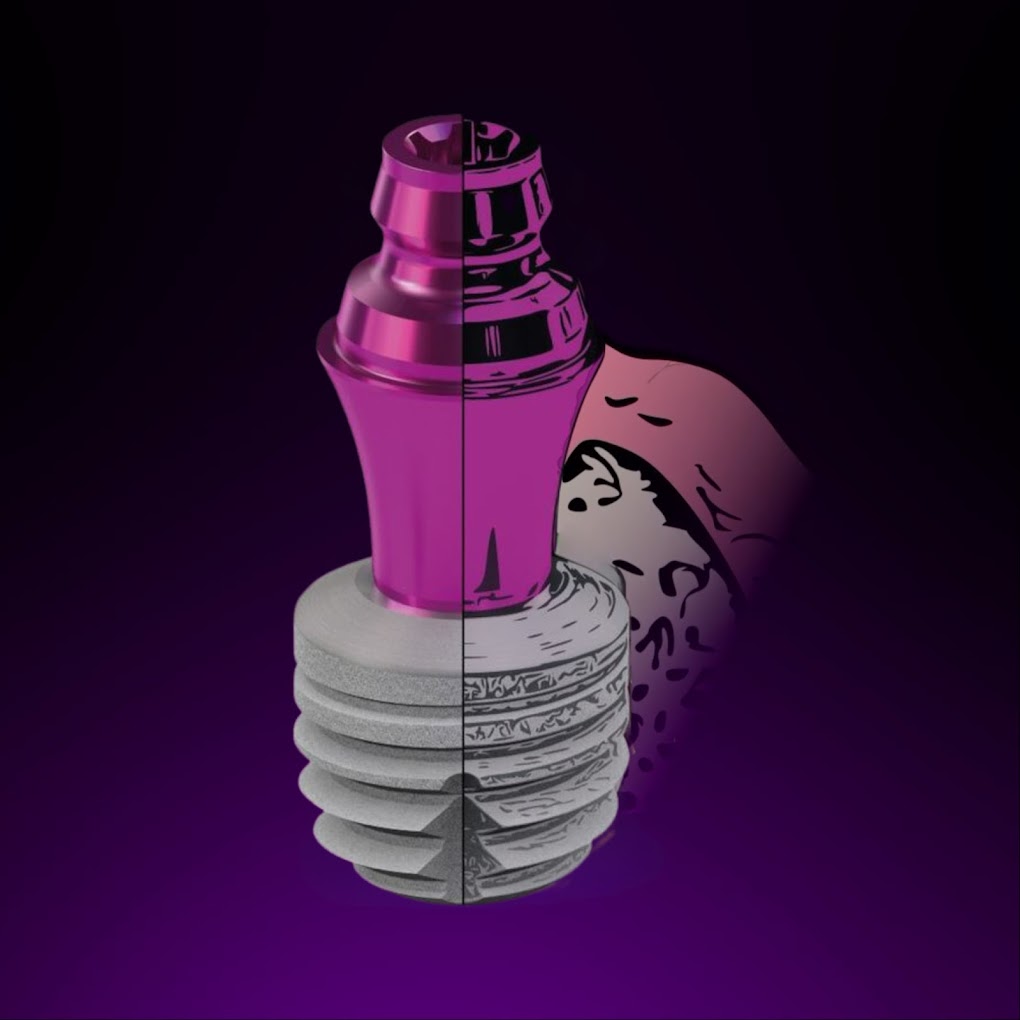 Implant dentar Bredent copaSKY