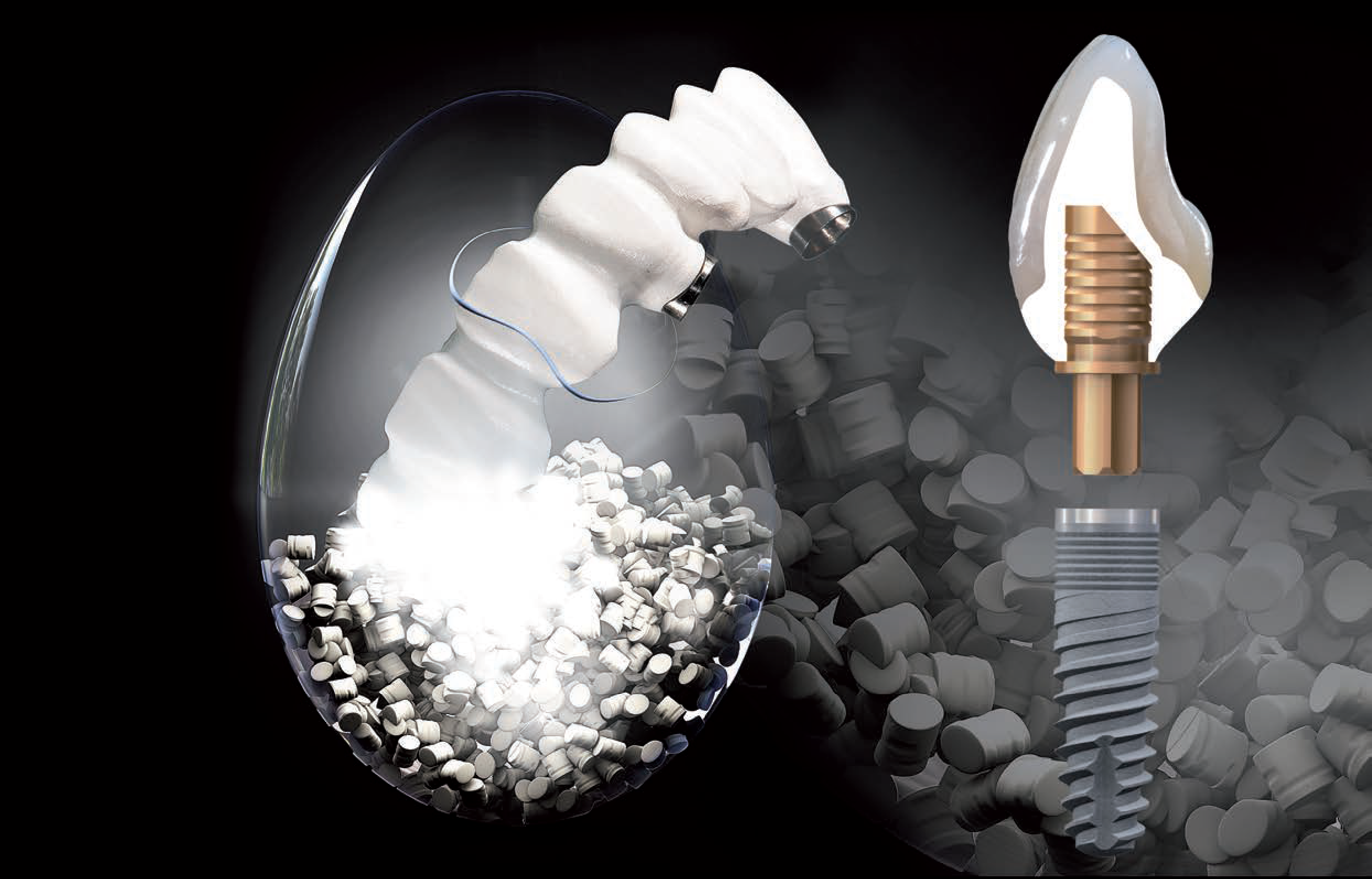 Sistem de implant dentar Bredent