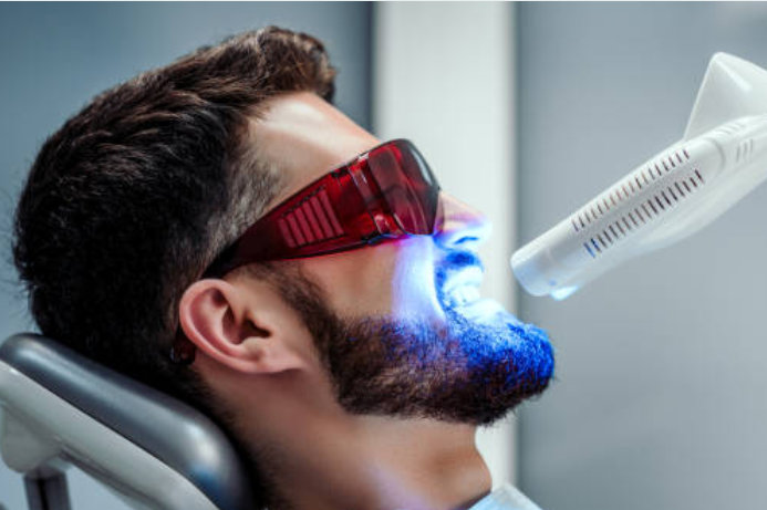 Albire dentară cu laser la DENTAL Arhitect