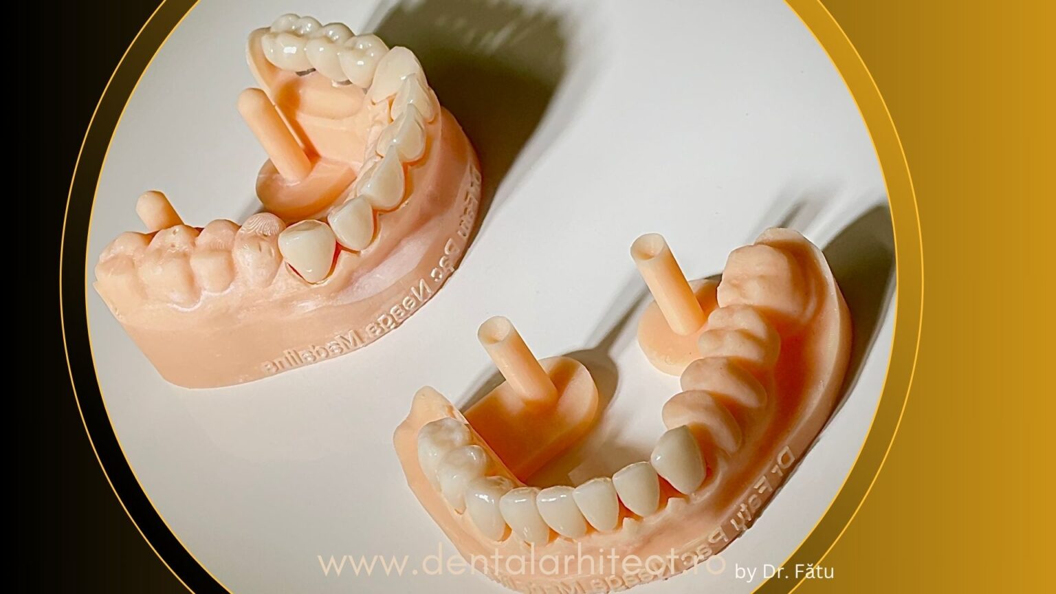 Coroane dentare din zirconiu realizate pentru restaurarea dinților