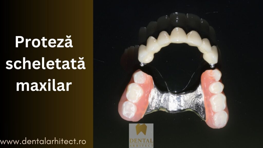 Caz clinic cu proteză scheletată în Sectorul 5