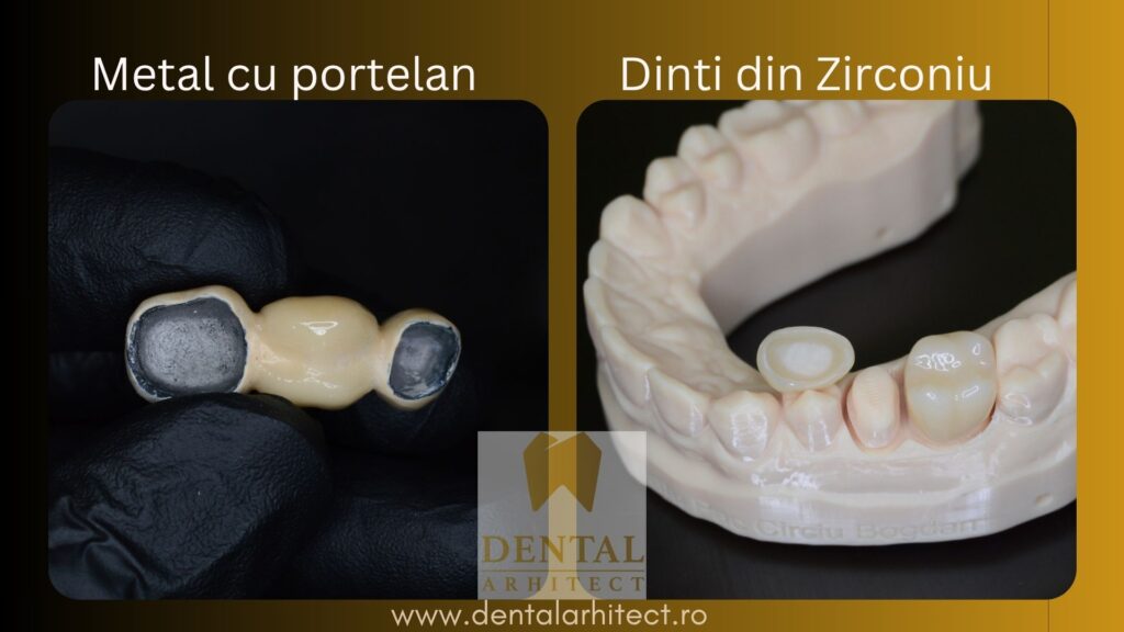 Exemplu de lucrare protetică dentară