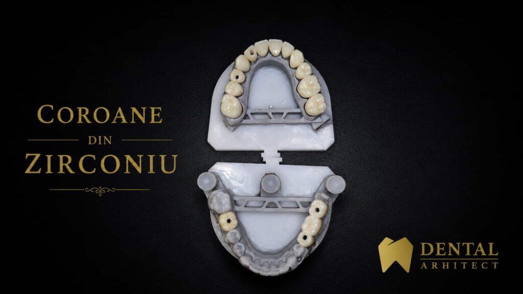 Coroană din zirconiu pe implant dentar