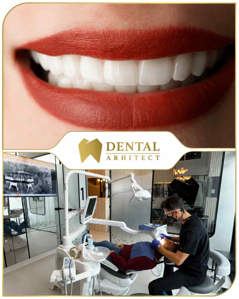 Coroane din zirconiu – caz clinic