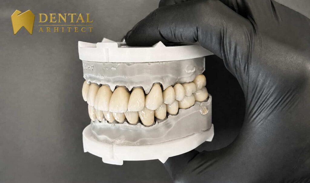 Lucrare dentară din zirconiu