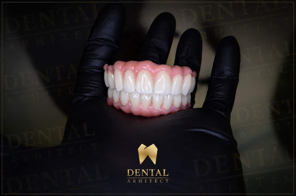 Lucrare protetică dentară – caz clinic