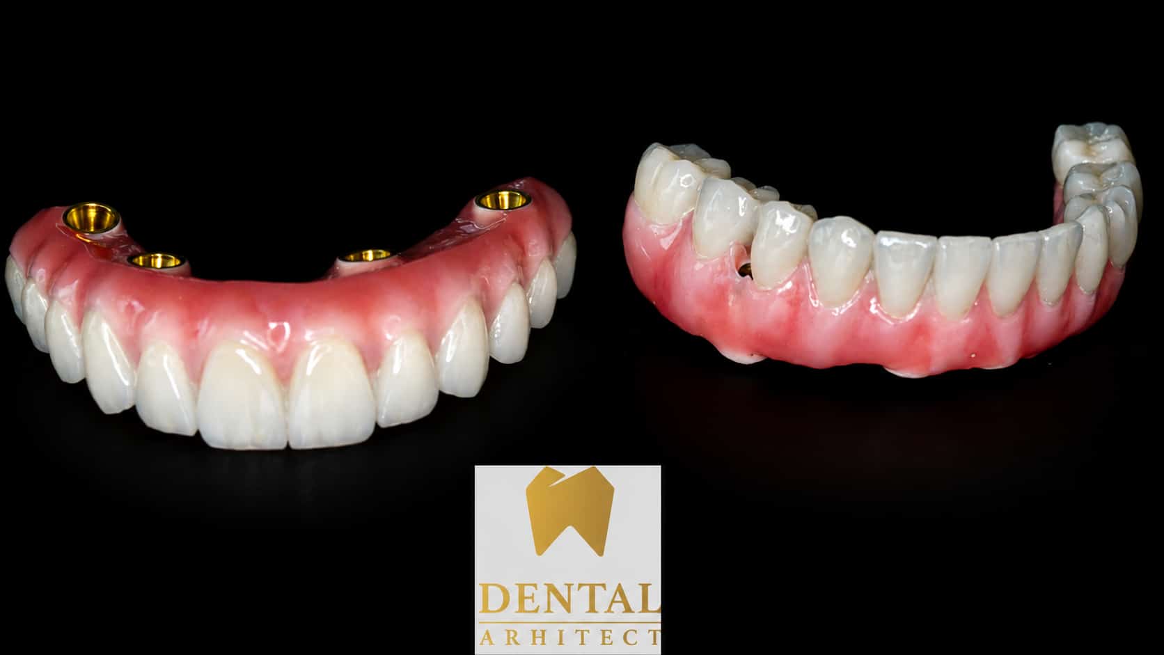 Lucrări dentare fixe complete pentru maxilar și mandibulă