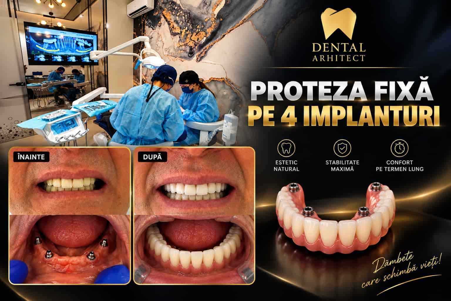 Caz clinic cu proteză fixă din porțelan pe patru implanturi dentare, înainte și după tratament