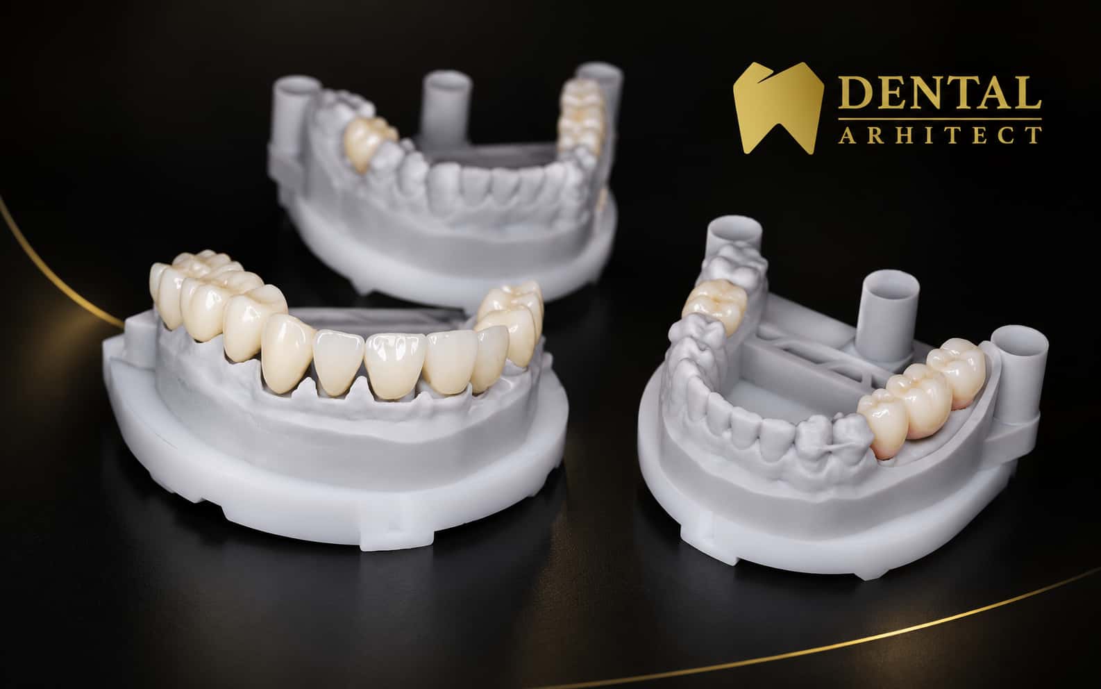 Lucrare protetică din zirconiu pe modele dentare, înainte de integrarea clinică
