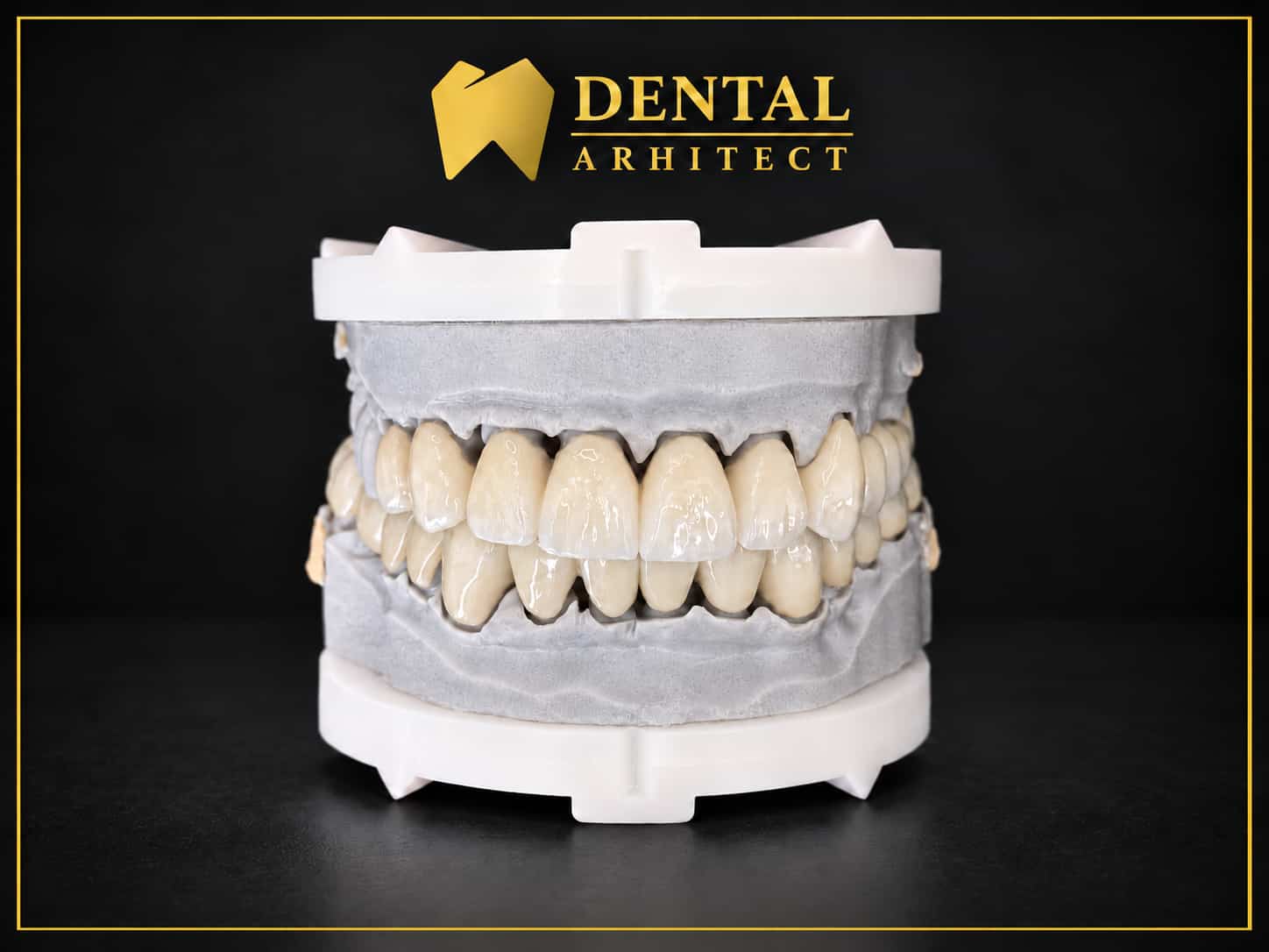 Lucrări dentare din zirconiu prezentate pe un model de laborator